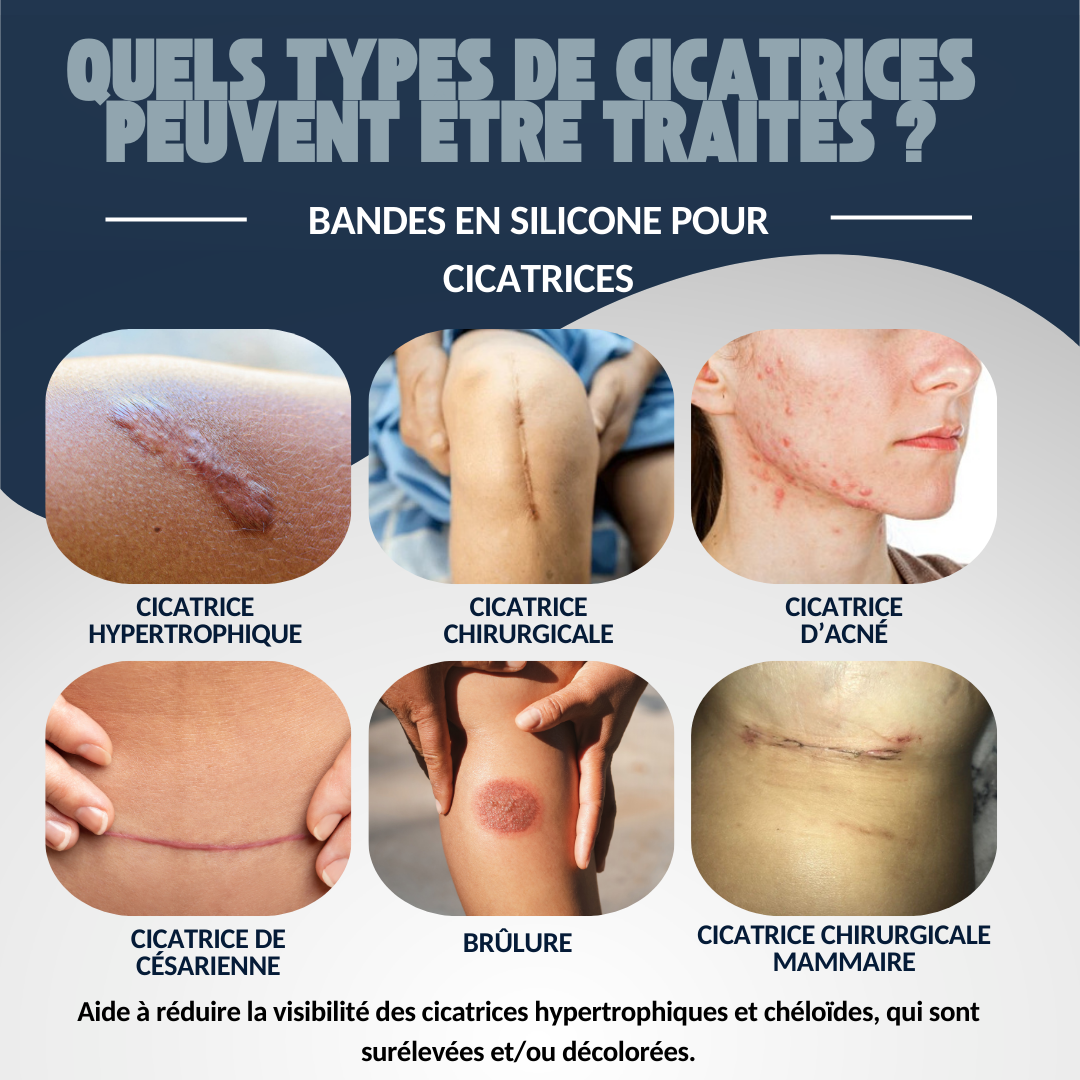 BUST'UP - BANDE SILICONE CICATRISANTE